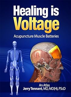 Healing is Voltage: Acupuncture Muscle Batteries: An Atlas (English Edition)  